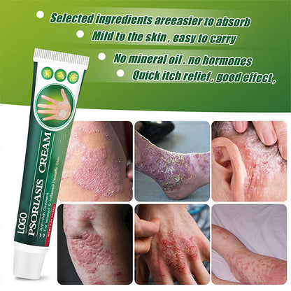 Psoriase
